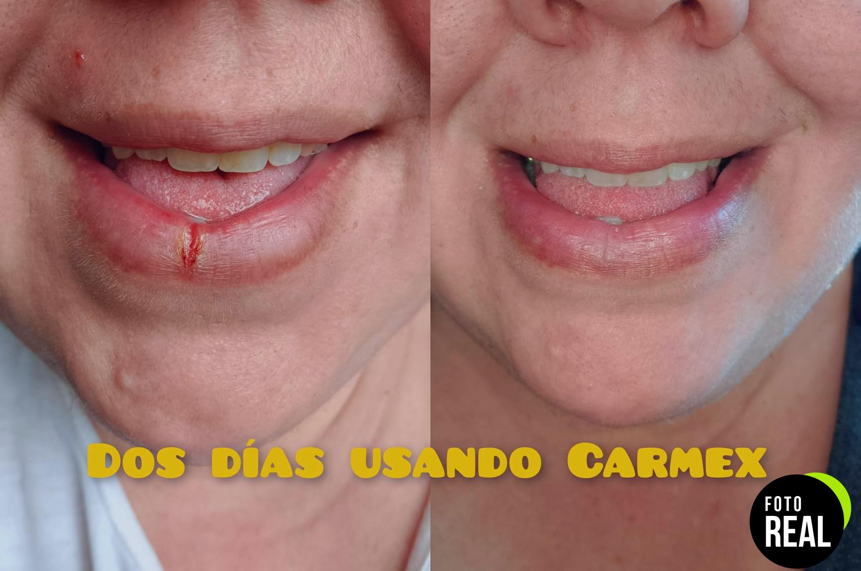 carmex-fresa-labial-15spf-10g-foto-3