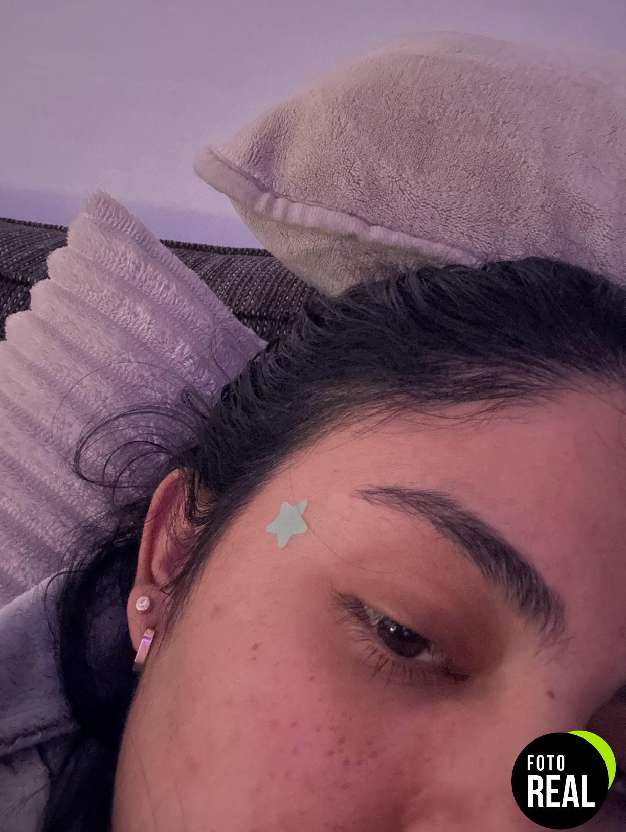 parches-acne-tea-240-foto-2