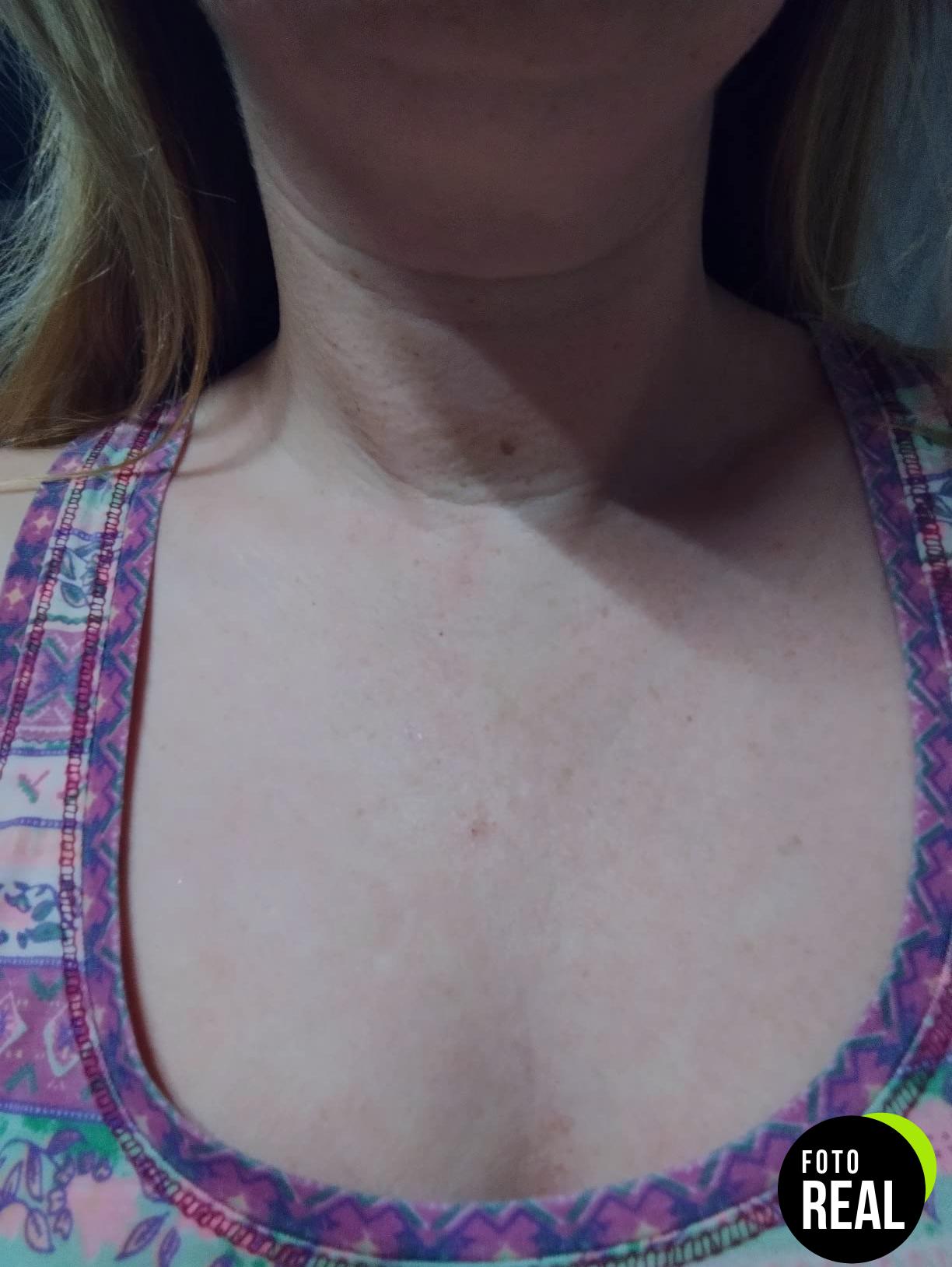 almohadilla-antiarrugas-silicona-pecho-1mes-foto-1